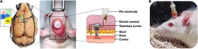 Long-Term Motor Cortical Electrical Stimulation Ameliorates 6-Hydroxydopamine-Induced Motor Dysfunctions and Exerts Neuroprotective Effects in a Rat Model of Parkinson’s Disease